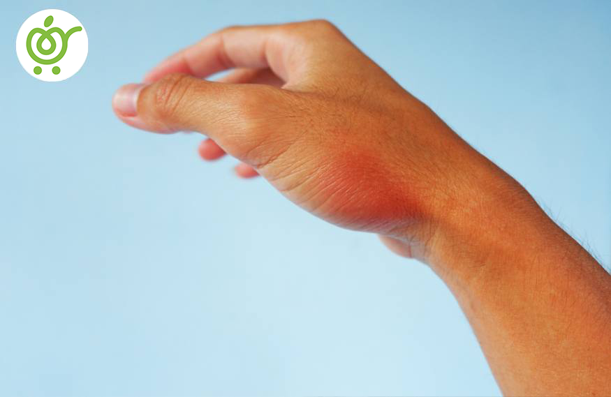 آرتریت-سپتیک-745 آرتریت-سپتیک-745