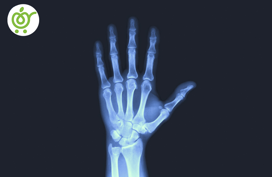 اشعه-ایکس-874 اشعه-ایکس-874