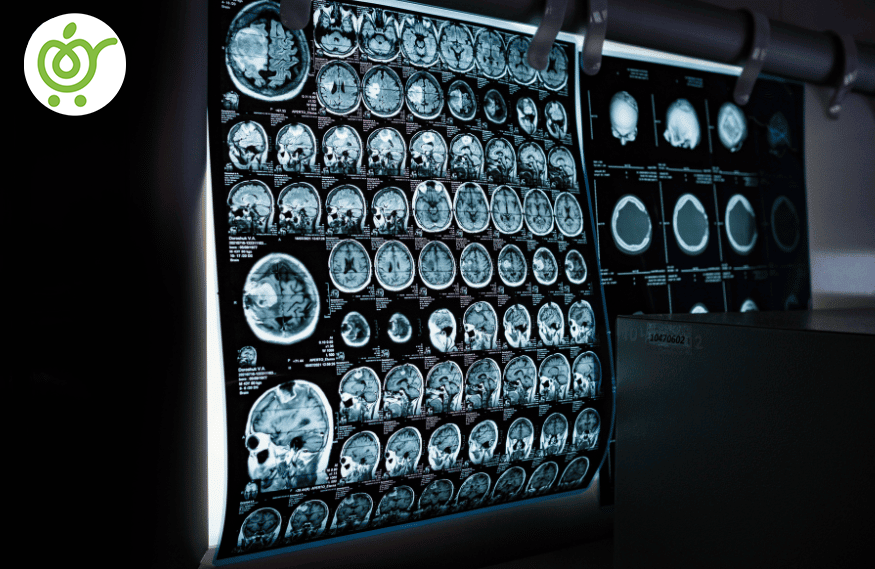 ام-آر-آی-845 ام-آر-آی-845