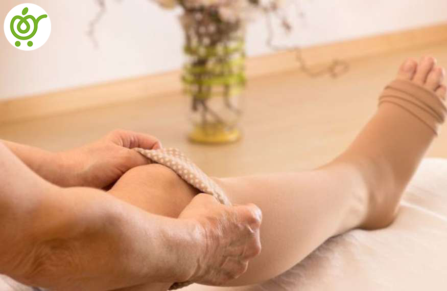 انتخاب-جوراب-واریس-مناسب