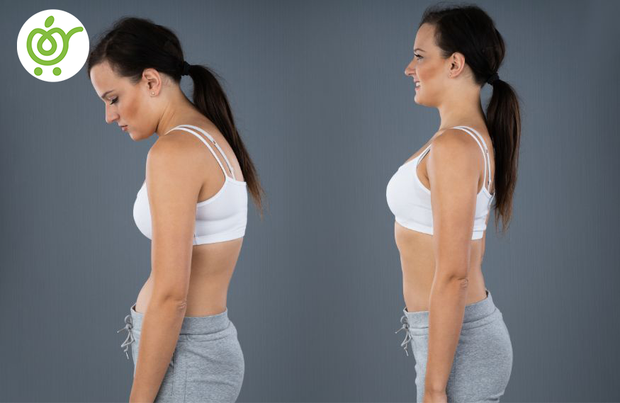 انحراف-ستون-فقرات-گودی-کمر-(لوردوز)