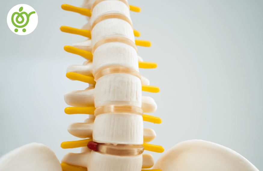 انواع-تنگی-کانال-نخاع-66 انواع-تنگی-کانال-نخاع-66