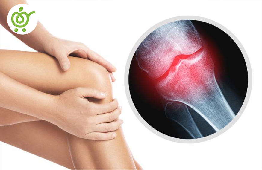 بیماری-عفونی-استخوان-و-مفاصل-34