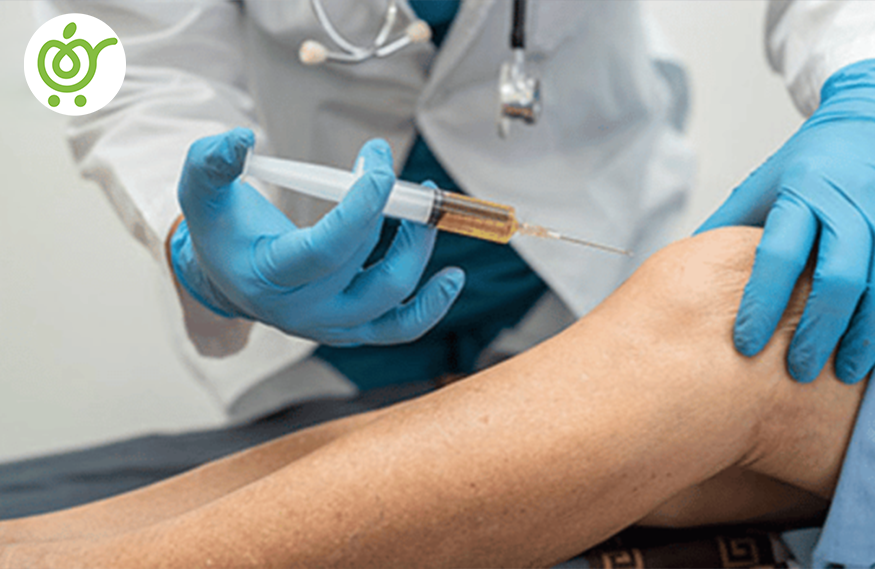 تزریق-prp-برای-درمان-آرتروز-زانو-چطور-است؟ تزریق-prp-برای-درمان-آرتروز-زانو-چطور-است؟