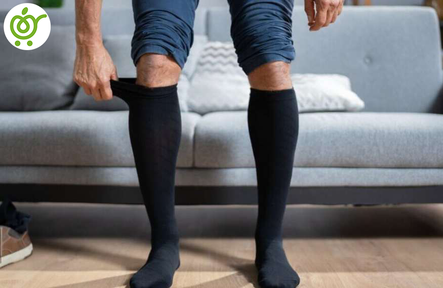 جوراب-واریس-چیست؟