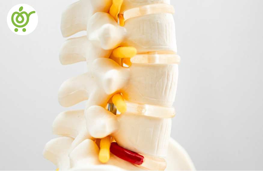 راههای-درمانی-موثر-در-درمان-دیسک-کمر راههای-درمانی-موثر-در-درمان-دیسک-کمر