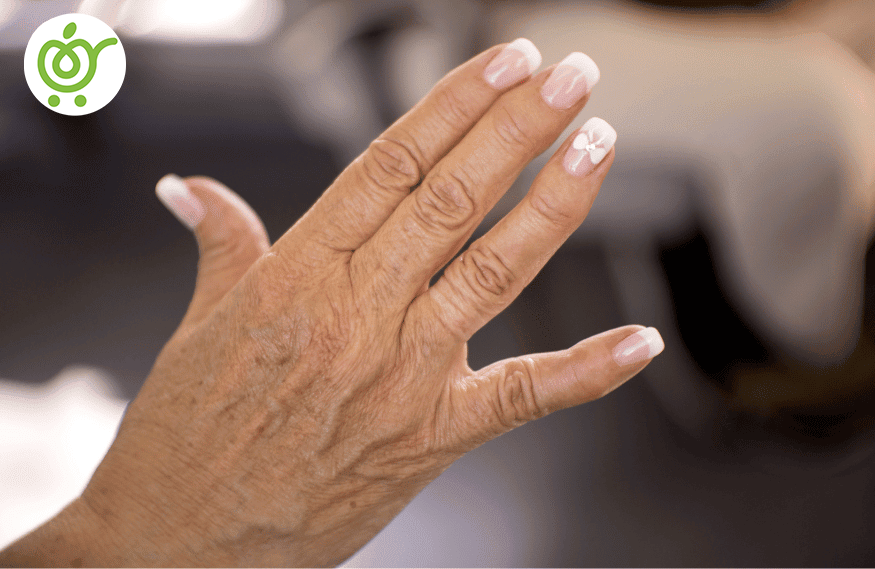 روماتیسم-یا-آرتریت-روماتوئید-66 روماتیسم-یا-آرتریت-روماتوئید-66