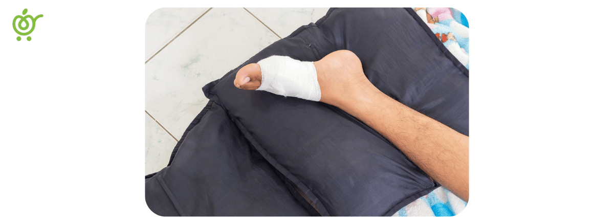زخم-انگشت-شست-پا-دیابتی-2 زخم-انگشت-شست-پا-دیابتی-2