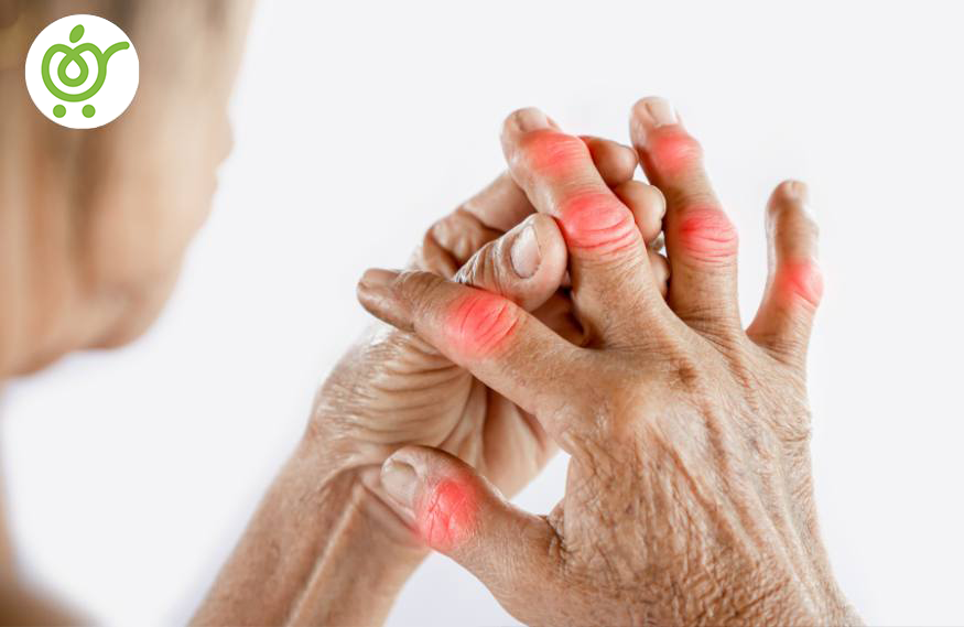 شایعترین-دلیل-ورم-مفاصل-58 شایعترین-دلیل-ورم-مفاصل-58