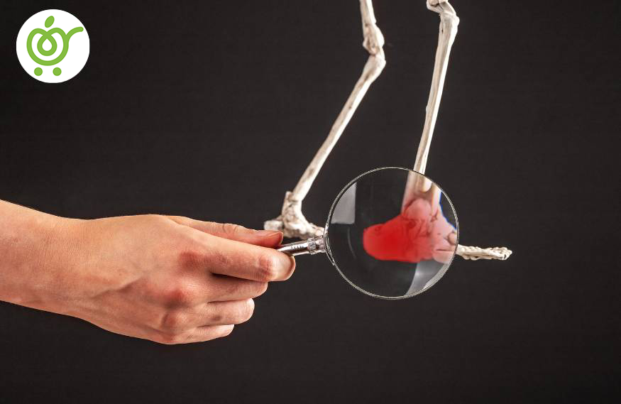 علائم-خار-استخوانی-می‌تواند-چه-چیزهایی-باشد؟-32