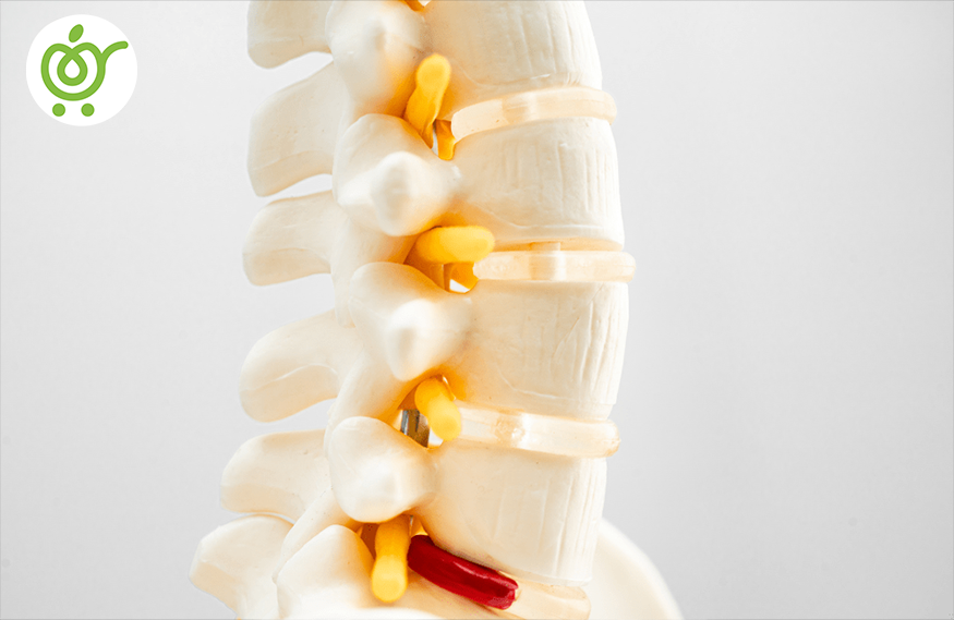 علائم-روماتیسم-ستون-فقرات-35 علائم-روماتیسم-ستون-فقرات-35