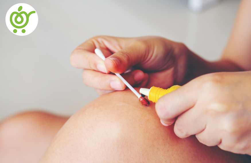 علائم-عفونت-زخم-858