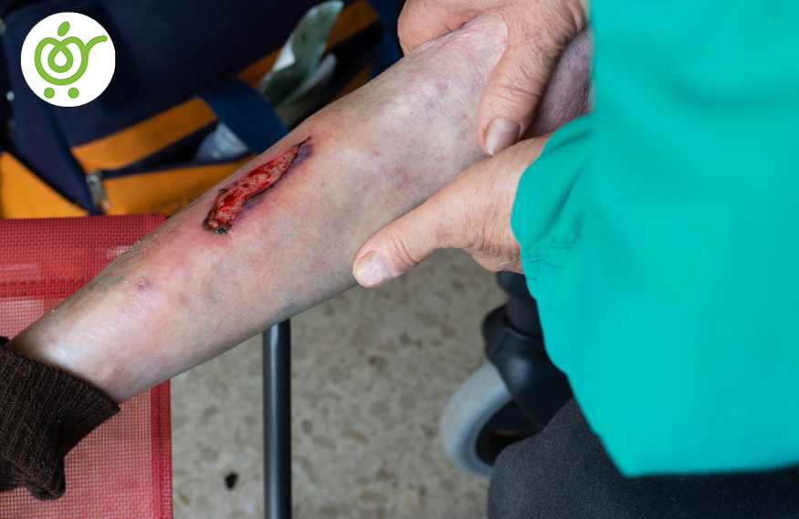 علت-ایجاد-زخم-بستر-86