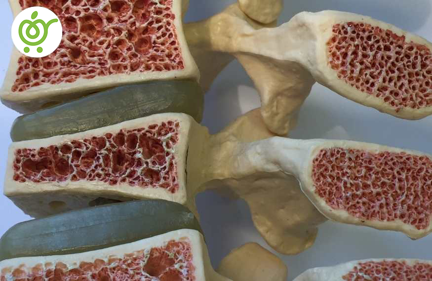 علت-بیماری-استئوپروز-چیست؟-8822 علت-بیماری-استئوپروز-چیست؟-8822