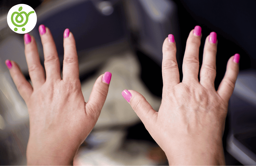 لوپوس-645 لوپوس-645