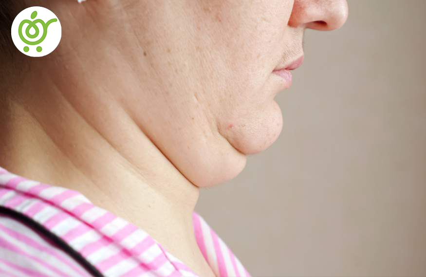 مدت-زمان-استفاده-از-گن-غبغب-چه-میزان-است؟-74