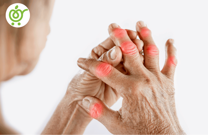 نقرس-452 نقرس-452