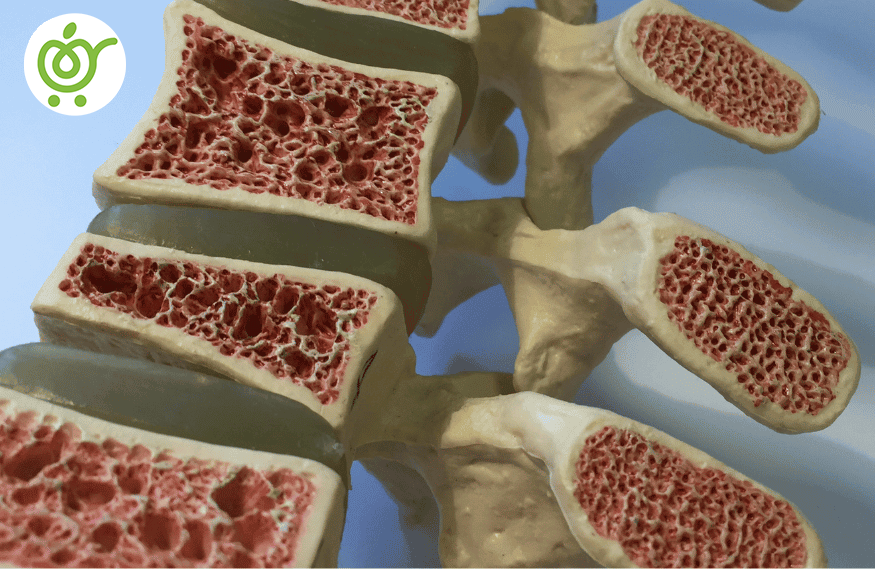 پوکی-استخوان-42 پوکی-استخوان-42