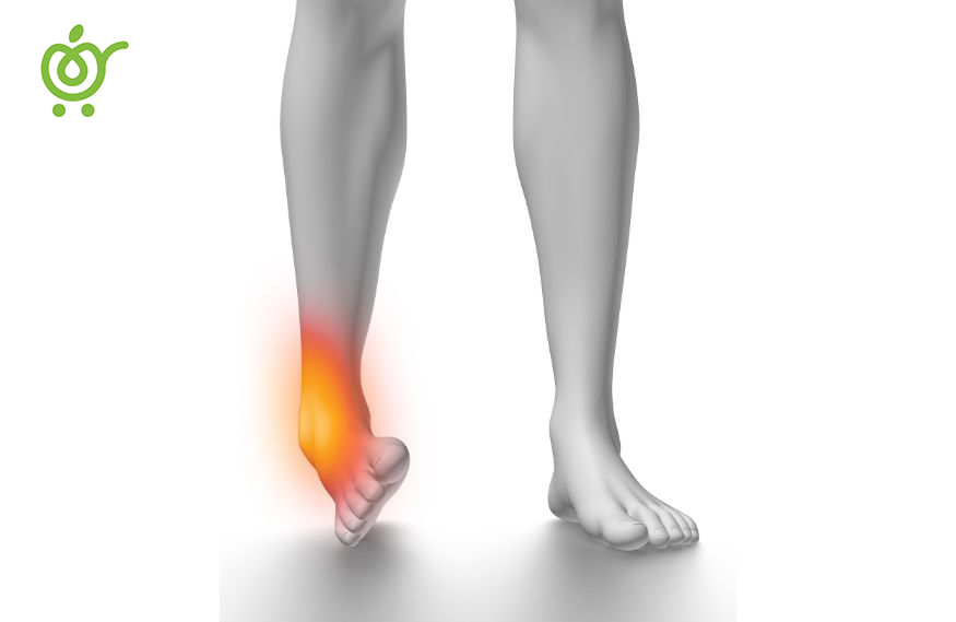 پیچ‌خوردگی-شایع‌ترین-علت-درد-مچ-پا