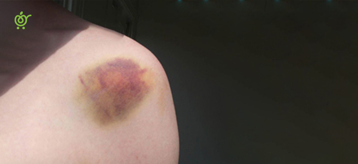 9876543258 9876543258