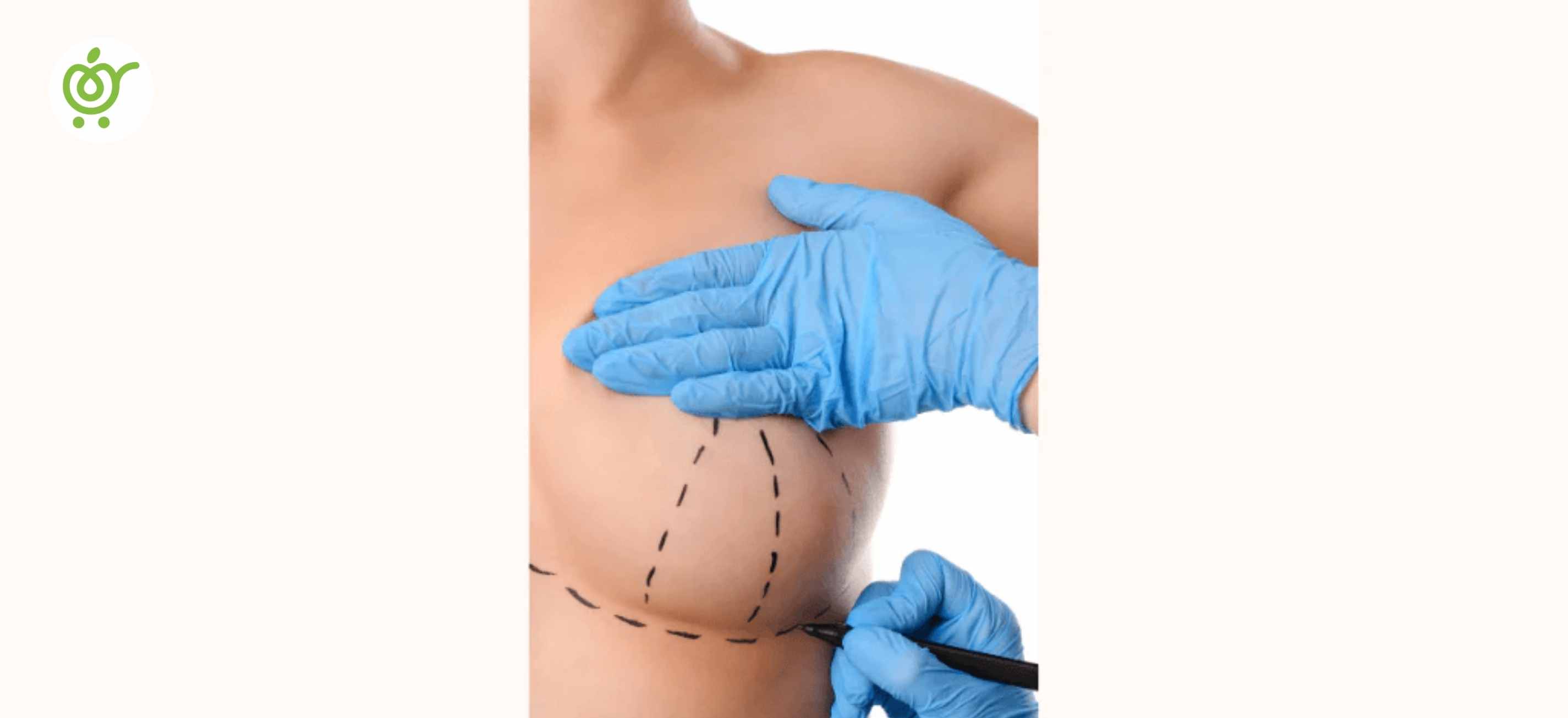 Anchor-or-Wise-Pattern-Incision