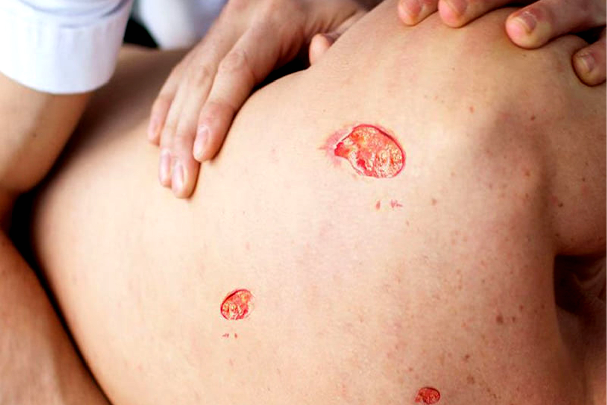 zakhm-bastar zakhm-bastar