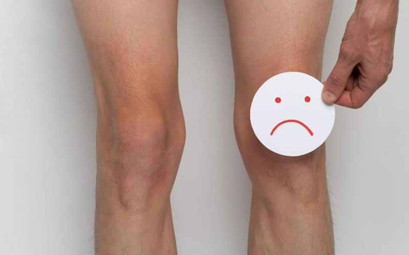 آب-آوردن-زانو آب-آوردن-زانو