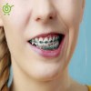 موم ارتودنسی آمیدن Amiden کره‌ای ( تاریخ 2029/11)