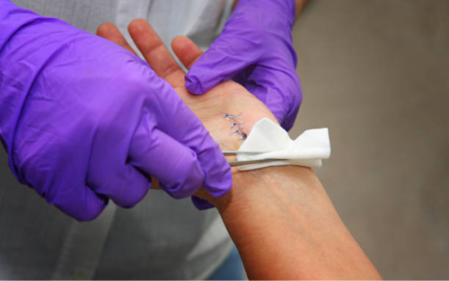 برای-بهبود-زخم-جراحی-چه-بخوریم