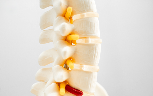 تمام-آنچه-که-در-مورد-روماتیسم-ستون-فقرات-باید-بدانید!