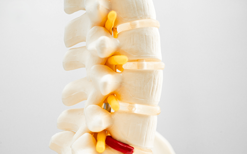 تمام-آنچه-که-در-مورد-روماتیسم-ستون-فقرات-باید-بدانید! تمام-آنچه-که-در-مورد-روماتیسم-ستون-فقرات-باید-بدانید!