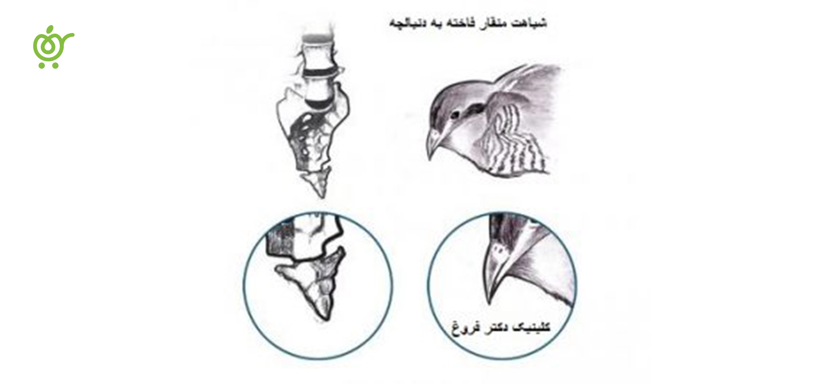درد-استخوان-دنبالچه.jpg-1 درد-استخوان-دنبالچه.jpg-1