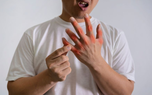 درمان-خشک-شدن-انگشتان-دست