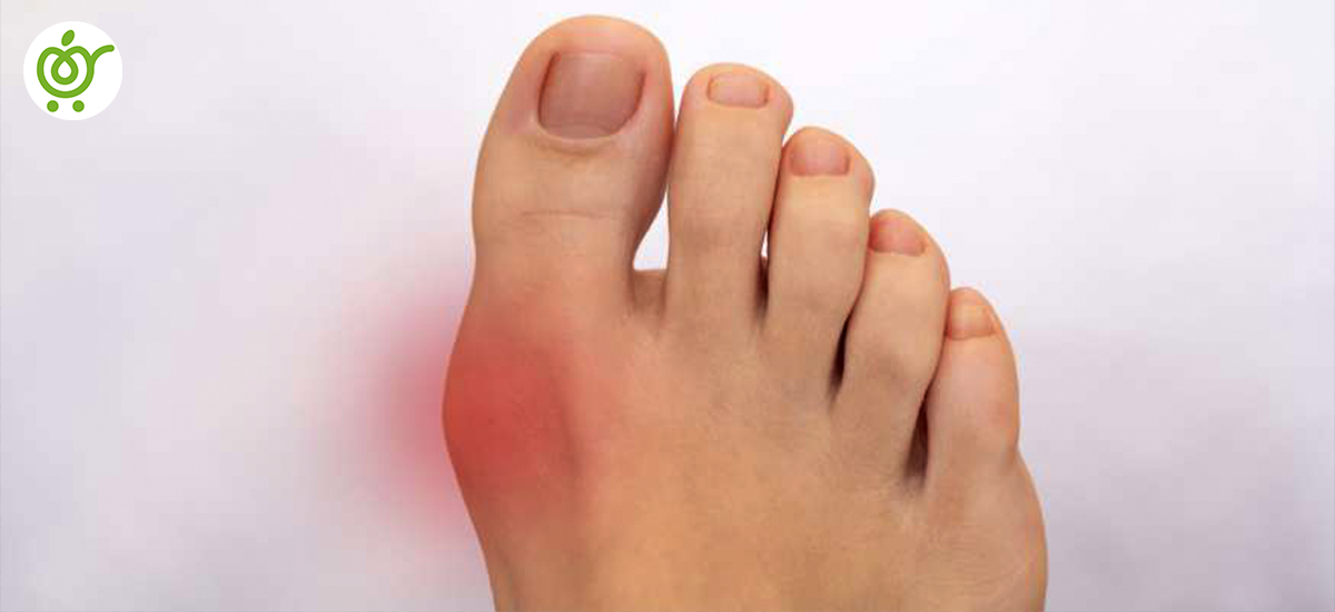 درمان-در-رفتگی-انگشت-پا