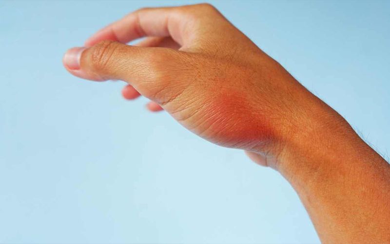 راه‌های-موثر-برای-درمان-آرتروز-انگشت-شست-دست