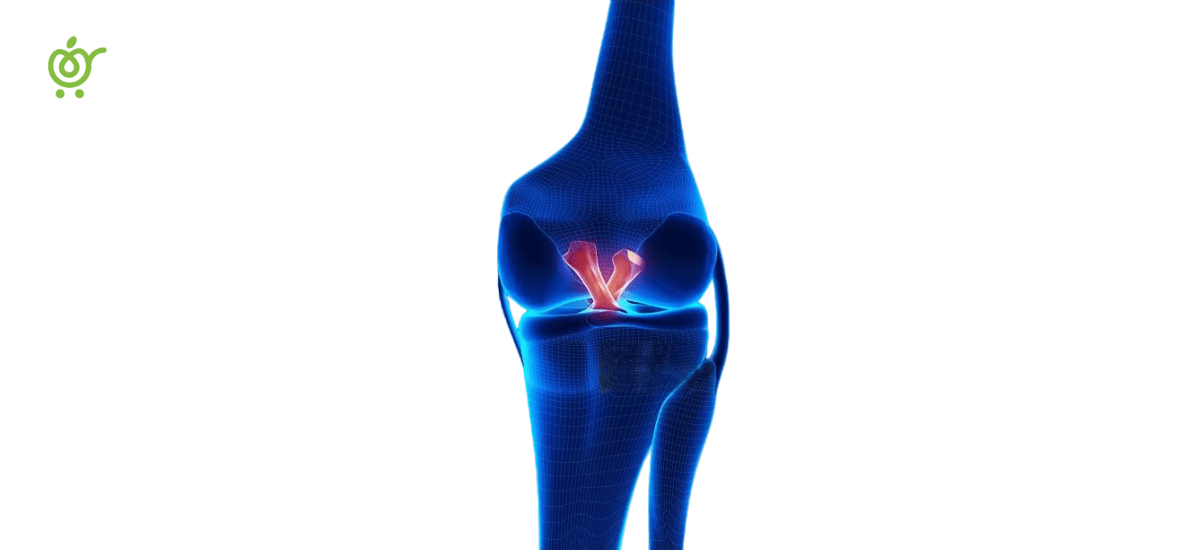 راه‌های درمان رباط صلیبی