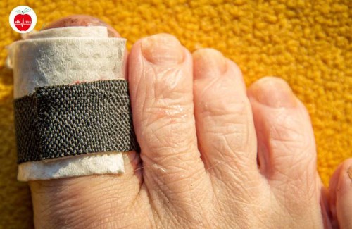 زخم-انگشت-شست-پا-نشانه-چیست-2