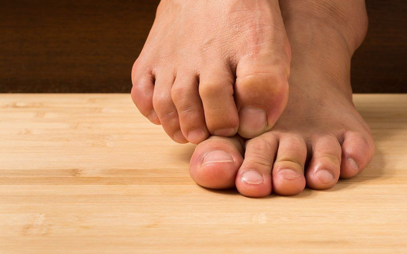 زخم-لای-انگشتان-پا زخم-لای-انگشتان-پا