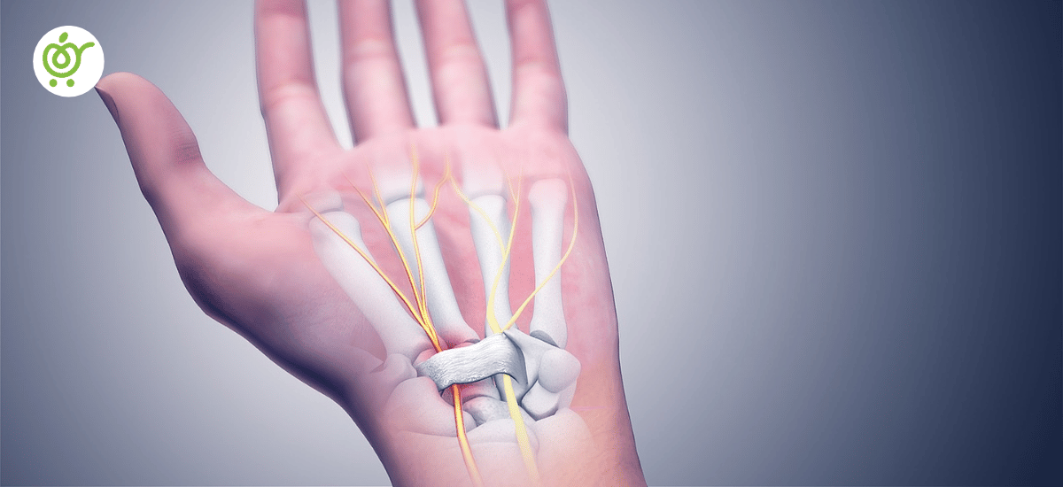 سندرم-تونل-کارپال-2