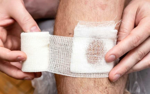 عفونت-زخم-چیست؟-راه‌های-پیشگیری-و-درمان-آن-چیست؟