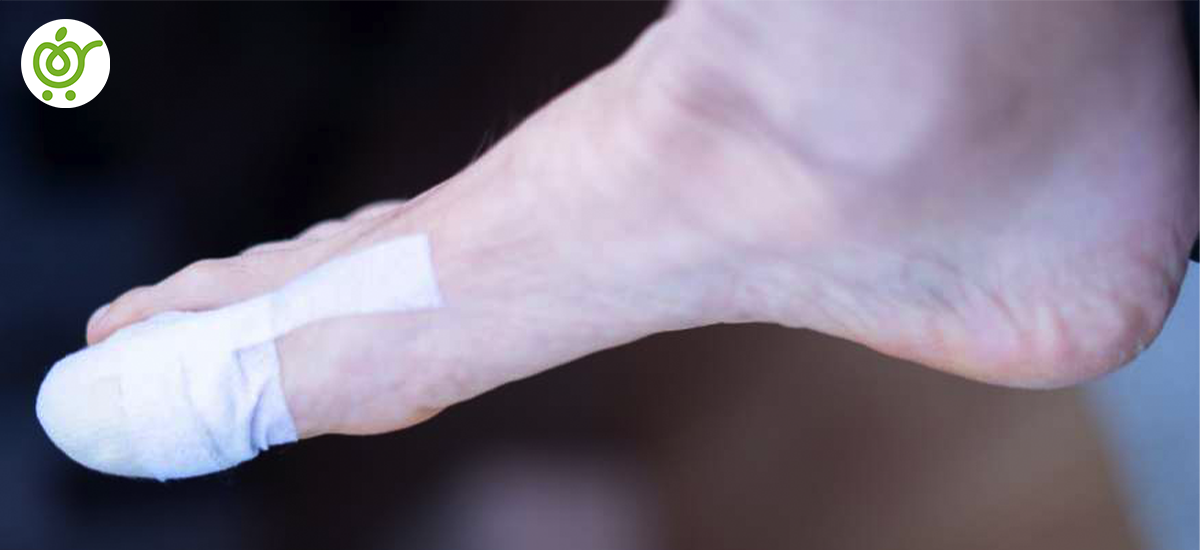 علائم-در-رفتگی-شست-پا