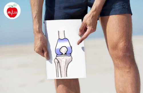 علت-تق-تق-کردن-زانو-4