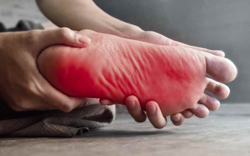 مقاله-سوزش-کف مقاله-سوزش-کف